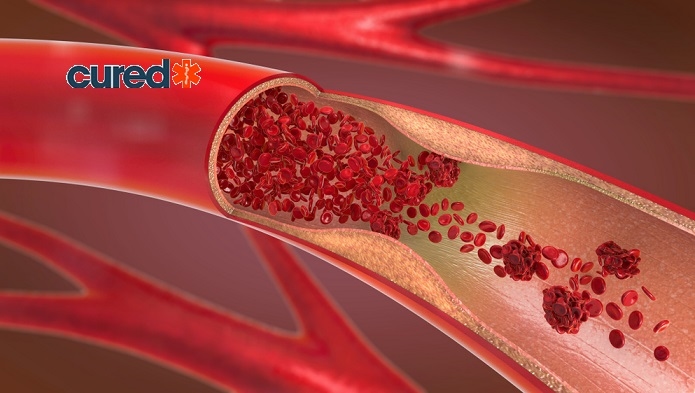 cured Improve Your Body Blood Flow