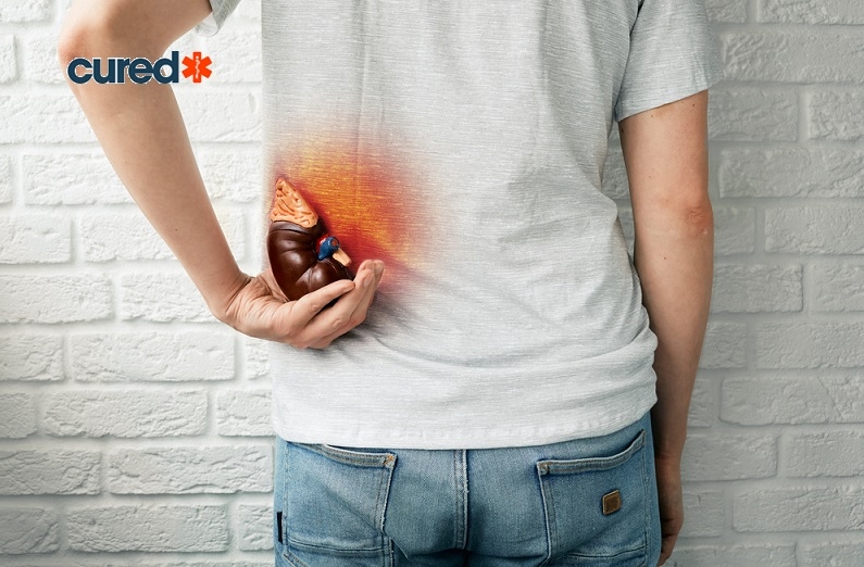 Cured  Prevention Of Recurrent Kidney Stones