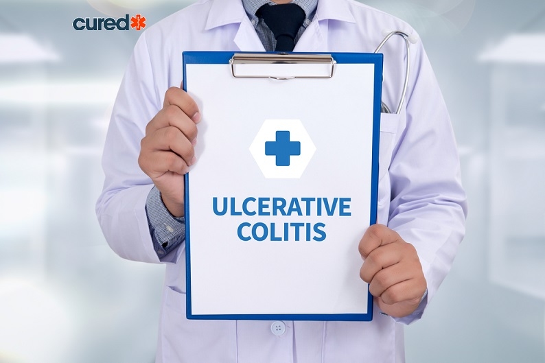 cured Ulcerative Colitis