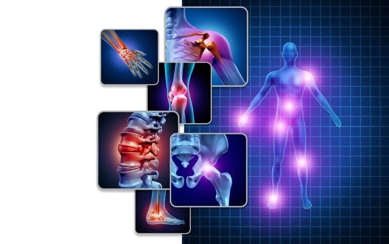 arthritis in various places of human body