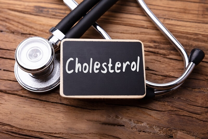 Cholesterol Word and Stethoscope On Wooden Table