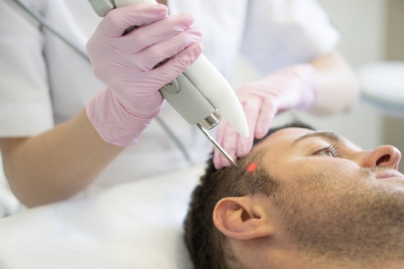 Laser treatment for hair loss