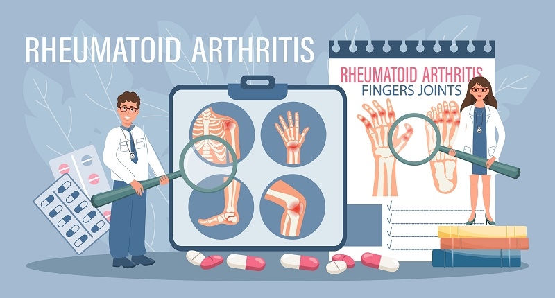 Rheumatoid arthritis treatment