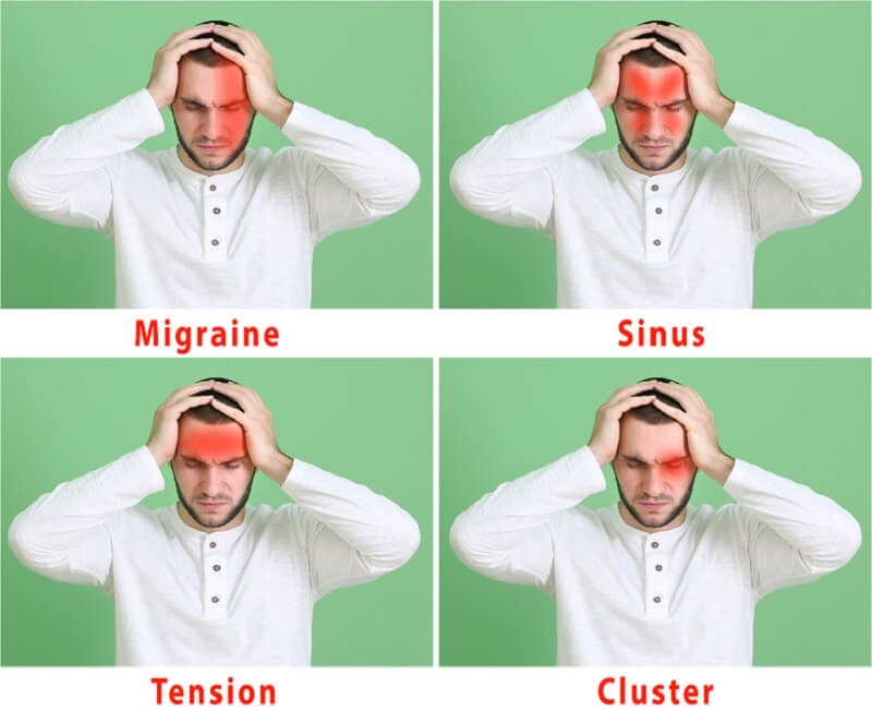 different types of headache