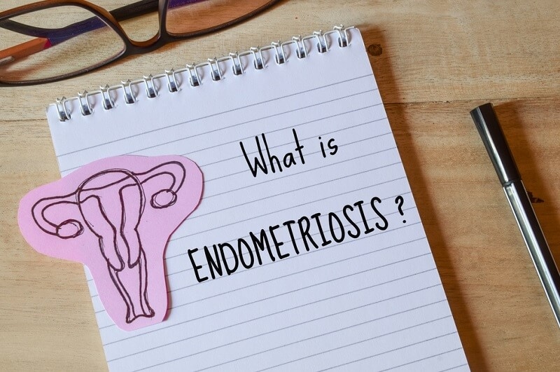 what is Endometriosis note and a drawn female reproductive system on desk