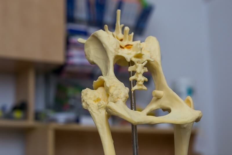 hip dysplasia