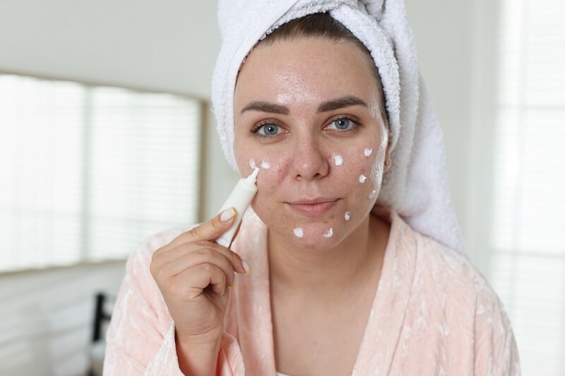 woman applying cream for acne
