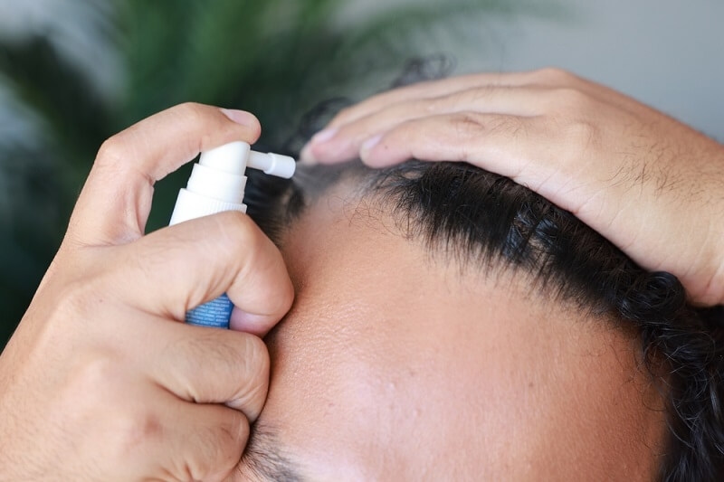 man applying minoxidil in hairs