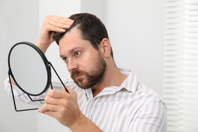 man looking at his receding hairline