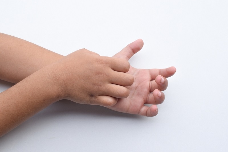 hand-disease