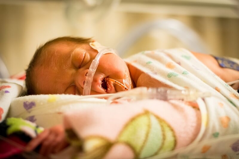 Micro Preemies Care, Causes, Complications and Development
