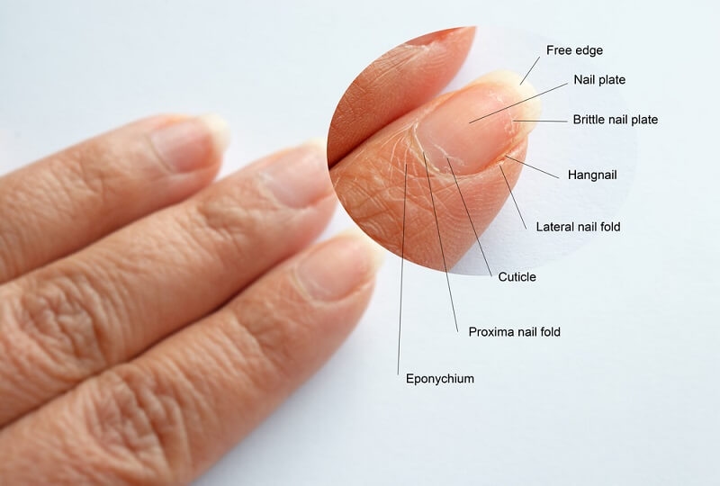 close up view of weak nails