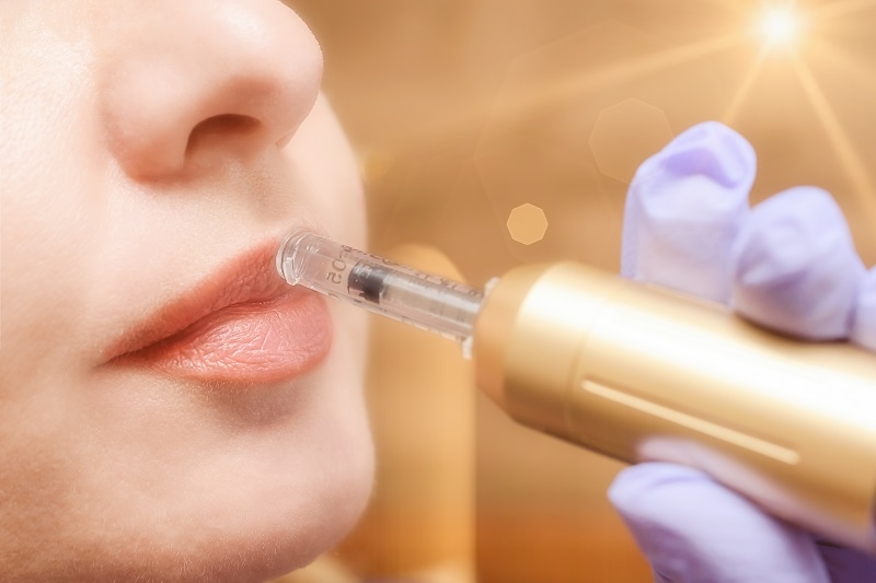 needle free jet injection