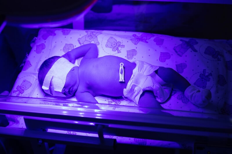 preemies baby in ultra violet light