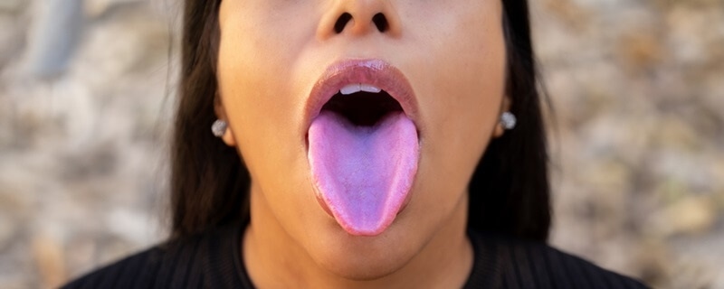 tongue-health-indicator
