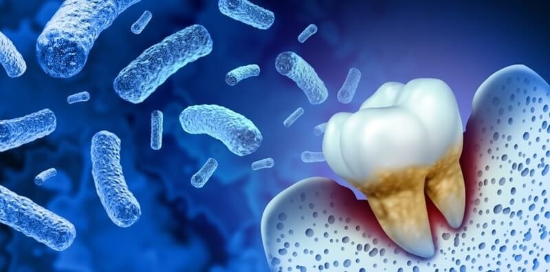 tooth-bacterial-infection-teeth-decay-disease