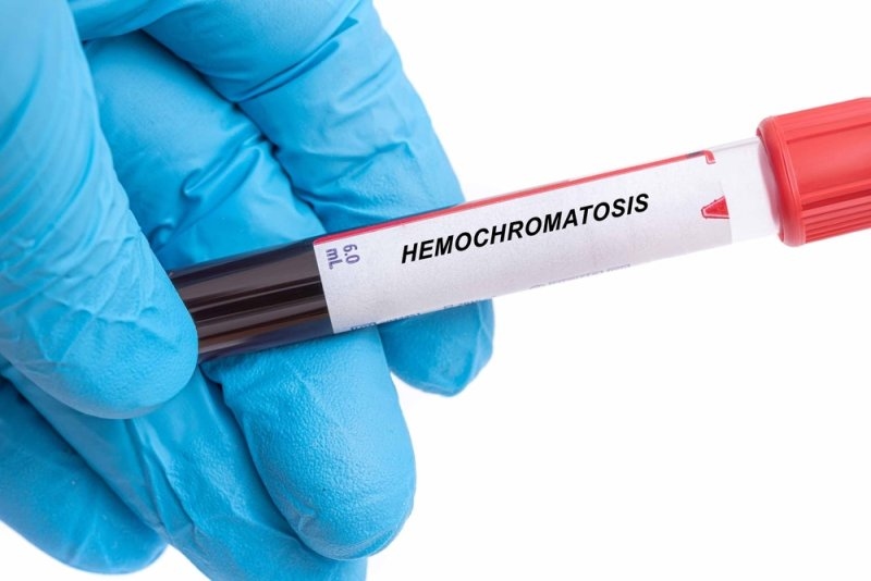 Hemochromatosis vial