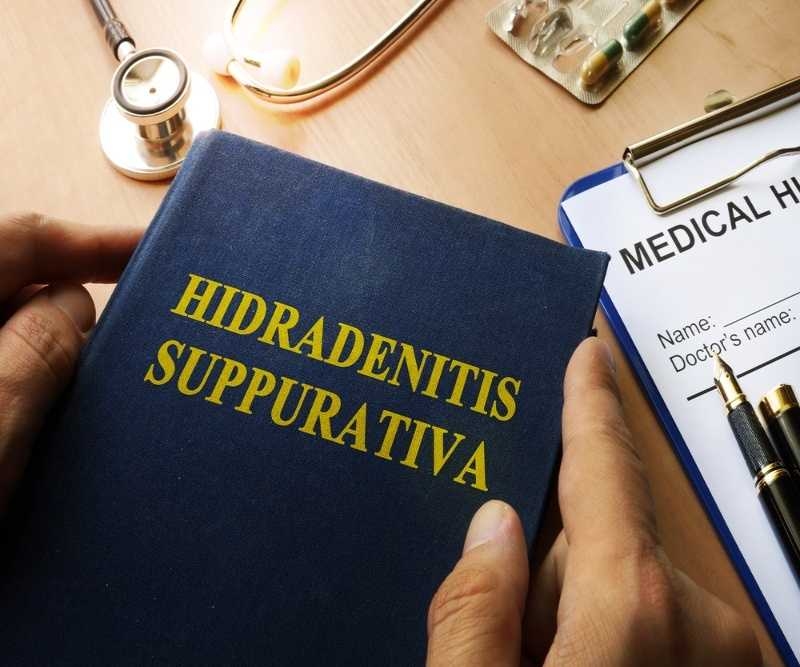 Book with title Hidradenitis Suppurativa on a table.