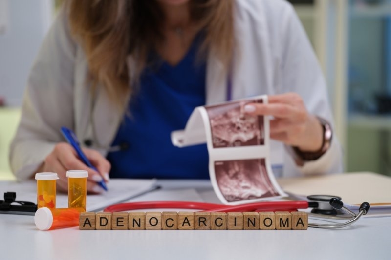 Doctor reviewing medical imaging while seated at a desk with prescription bottles and letter tiles spelling “ADENOCARCINOMA.”