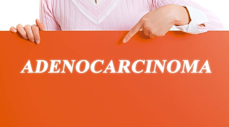 Person holding an orange sign labeled “ADENOCARCINOMA” while pointing toward the text.
