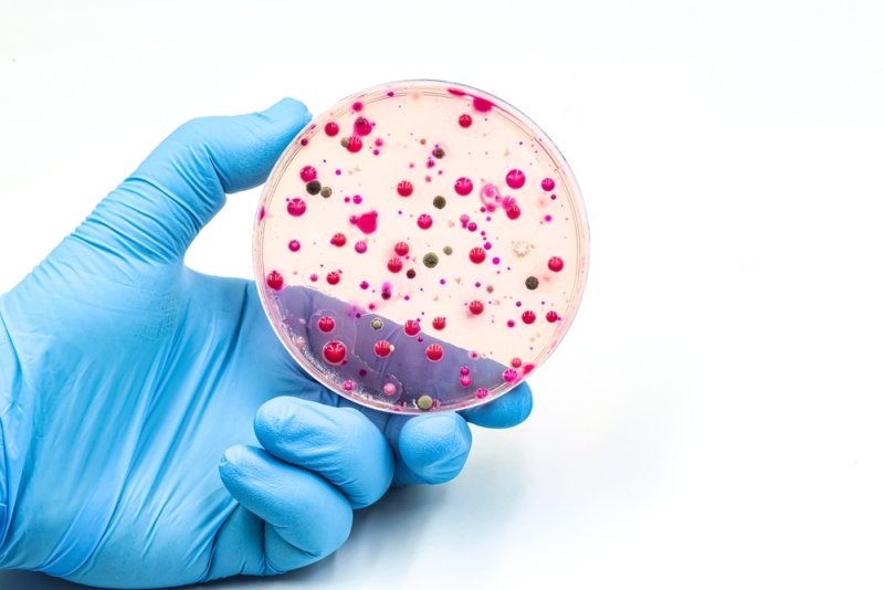 Infectious diseases