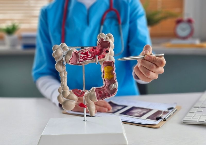 colorectal cancer