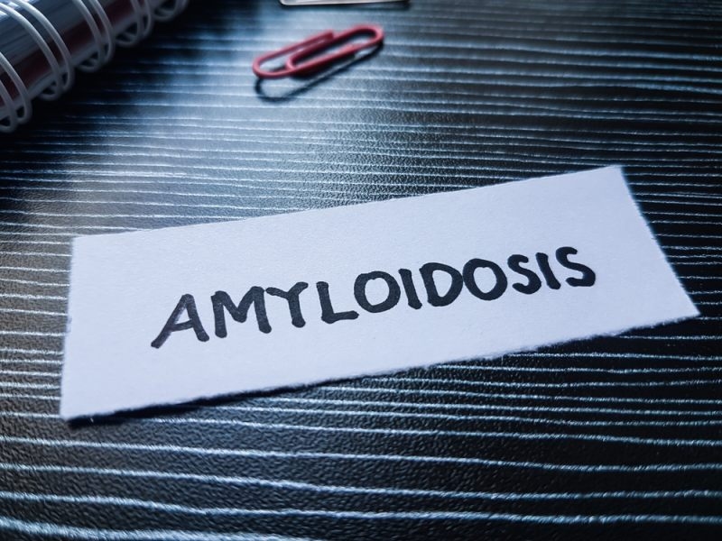 A Comprehensive Guide to Cardiac Amyloidosis Treatment 