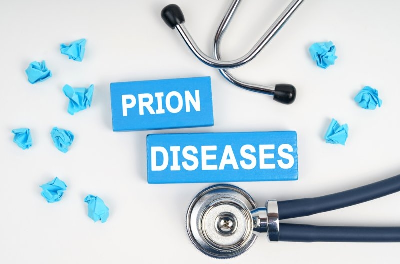 Prion Disease