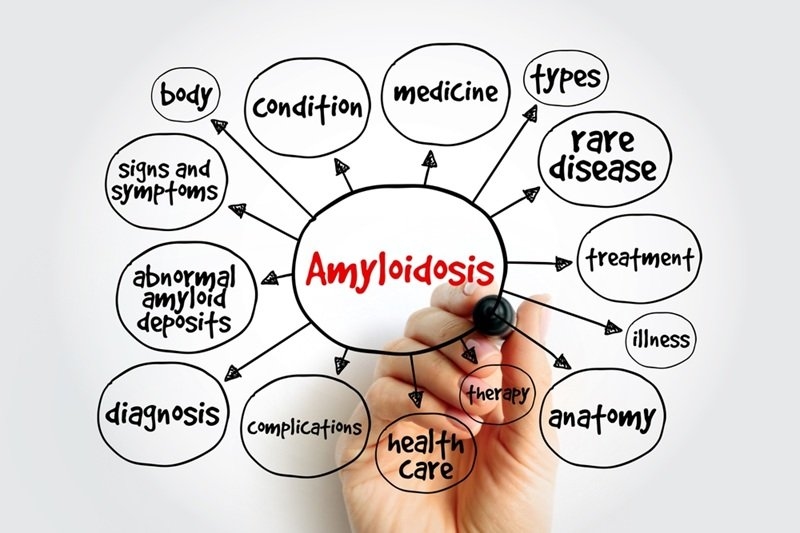 Holistic approach to managing cardiac amyloidosis