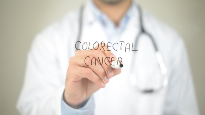 colorectal cancer