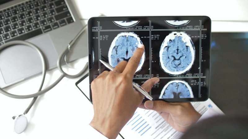 Medical professional examining brain CT scan images on a tablet during a clinical review.