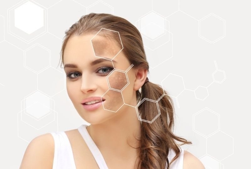 A women face highlighting skin issues such dark spots, freckles.