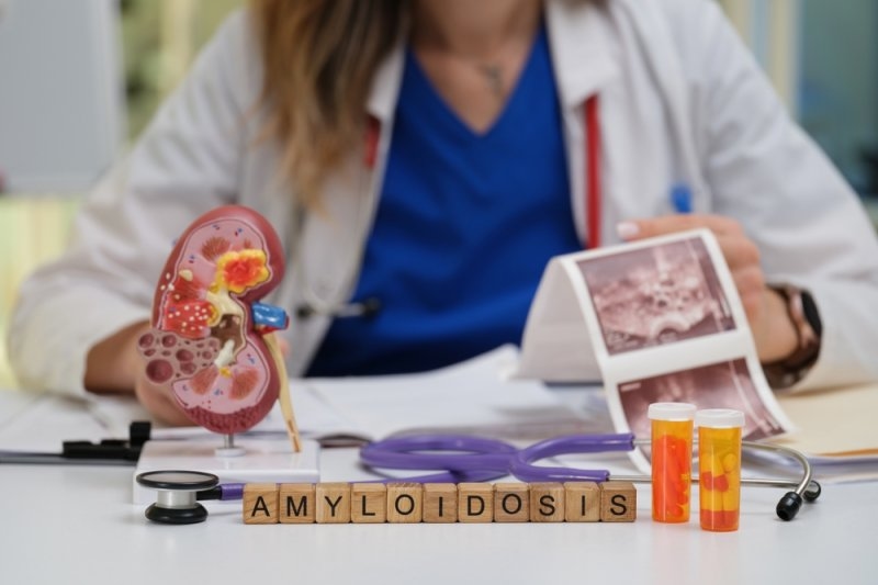 Holistic approach to managing cardiac amyloidosis