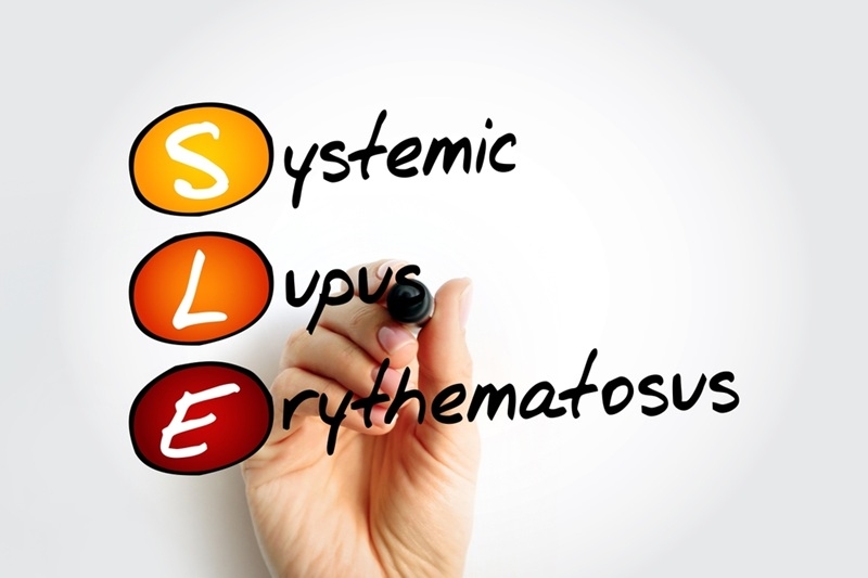 Lupus (SLE)