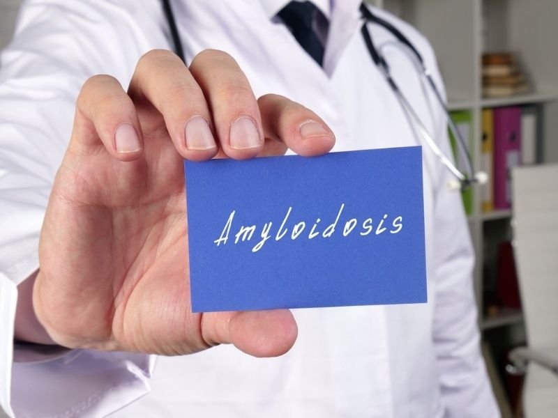 A medical professional in a white coat and stethoscope holds a blue card labeled “Amyloidosis.”