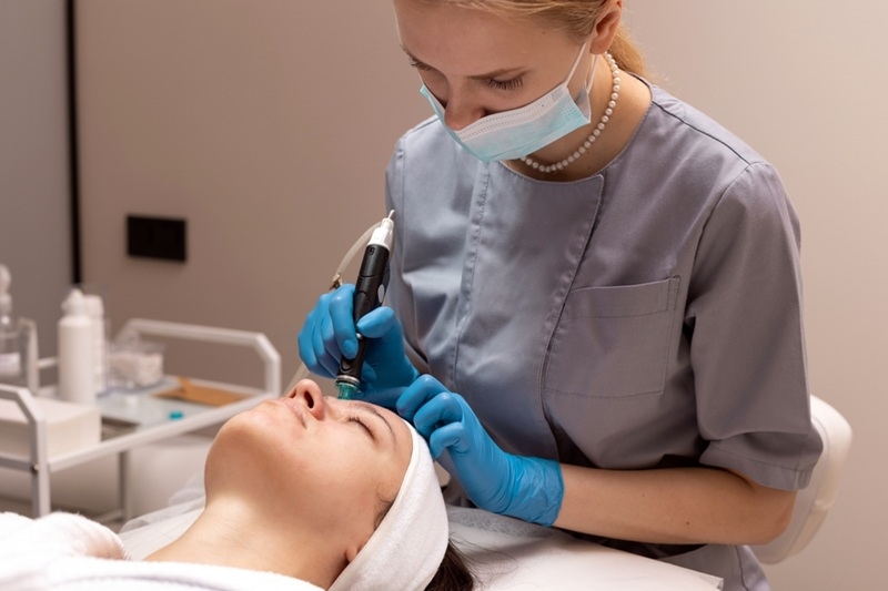 microneedling for face