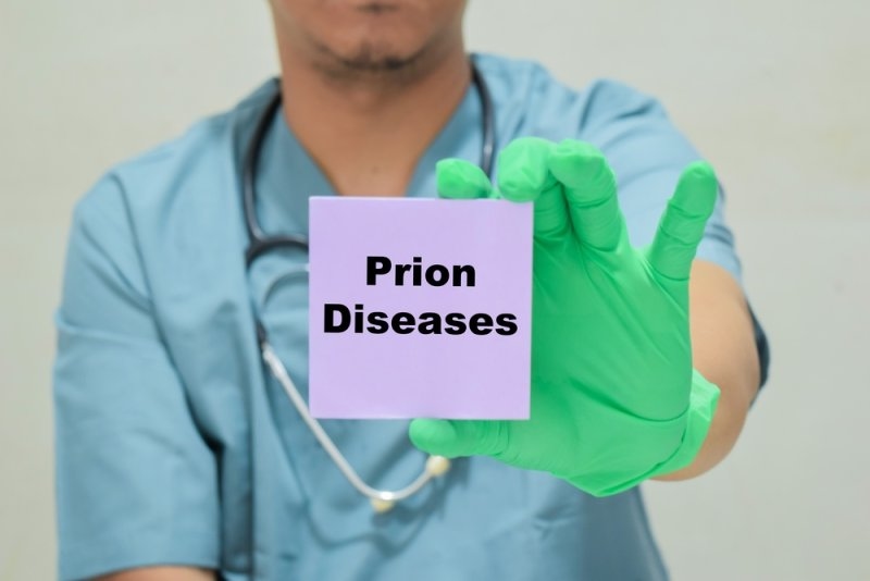 Prion Disease