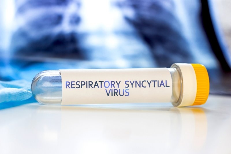 Laboratory test tube labeled “Respiratory Syncytial Virus” on a medical surface.