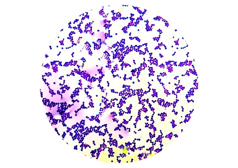 positive Staphylococcus appears in cluster form under the microscope