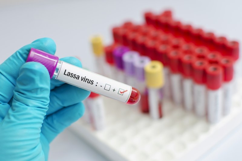 Lassa Fever
